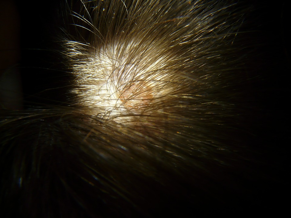 scalp-55956_960_720