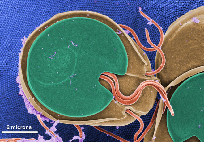 diarrheal-disease