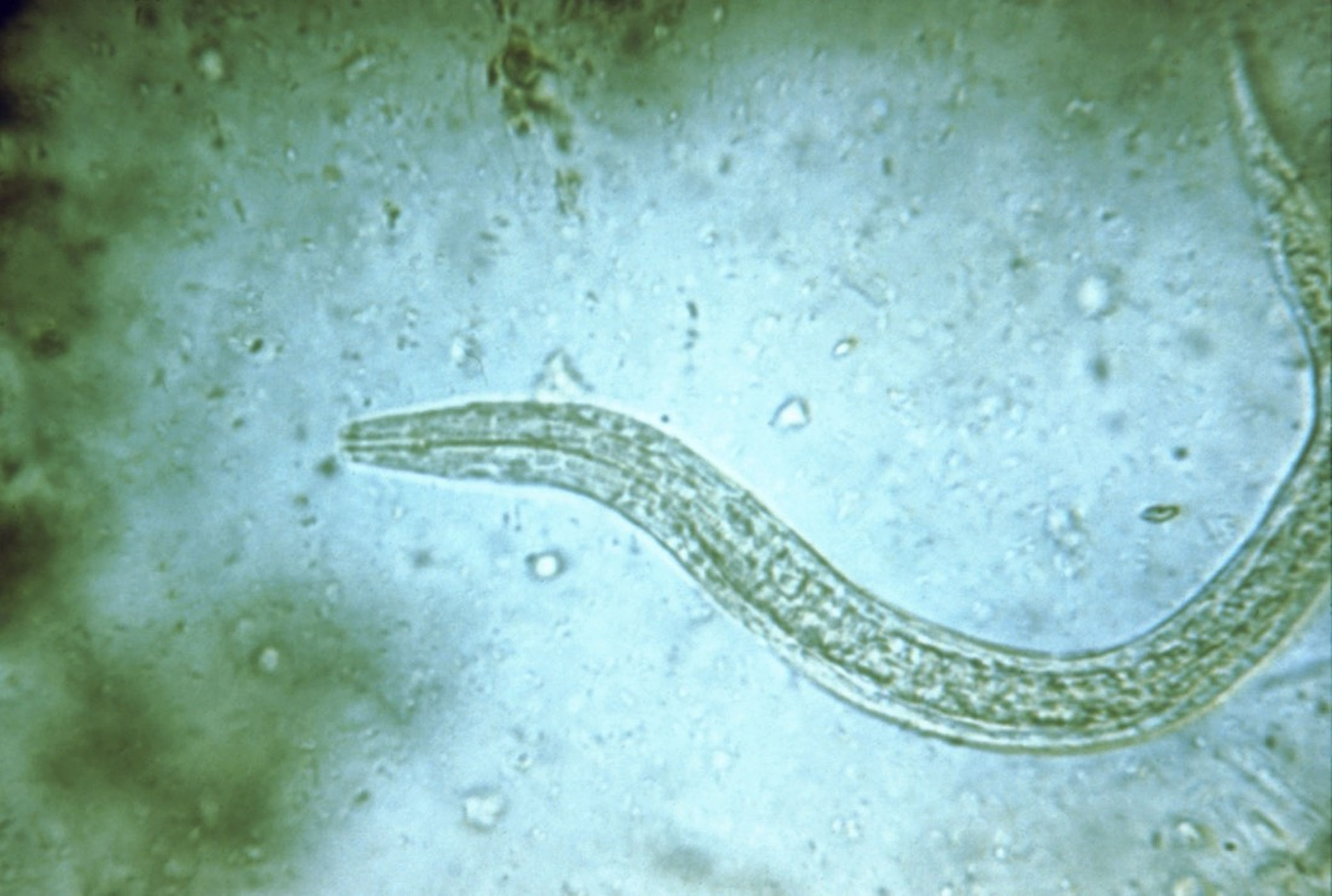 hookworms